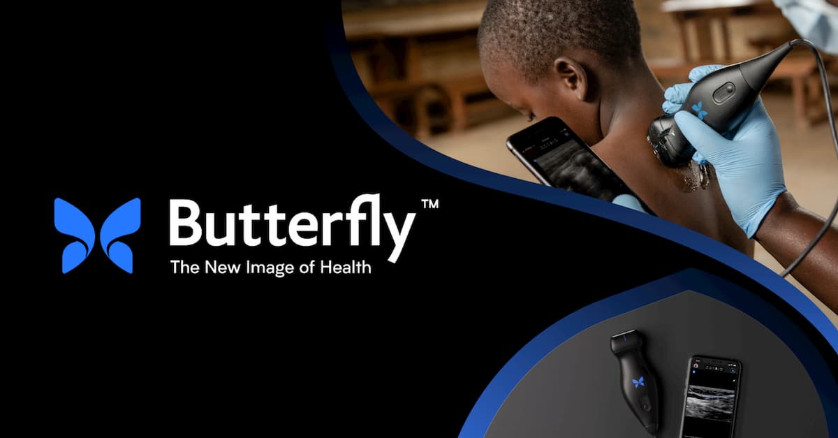 Butterfly Network to be listed on NYSE through a merger with Longview